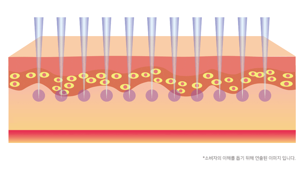보탬큐브 프로페셔널 (BS) (48개월) 상세 이미지 3